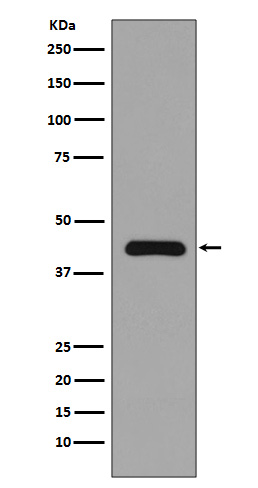 1 - Anti-MEK1 MAP2K1 Rabbit Monoclonal Antibody ABO13375