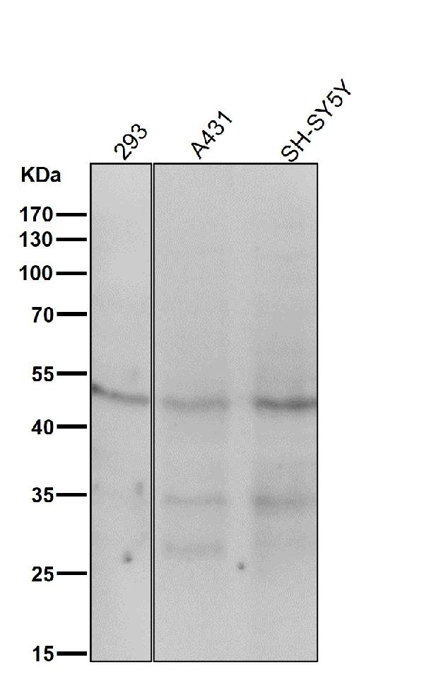 1 - Anti-MEK1 MAP2K1 Rabbit Monoclonal Antibody ABO13375