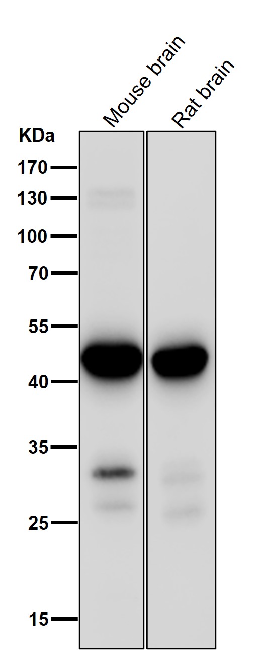 1 - Anti-MEK1 MAP2K1 Rabbit Monoclonal Antibody ABO13375