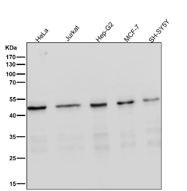 1 - Anti-MEK1 MAP2K1 Rabbit Monoclonal Antibody ABO13375