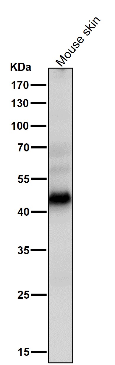 1 - Anti-MEK1 MAP2K1 Rabbit Monoclonal Antibody ABO13375