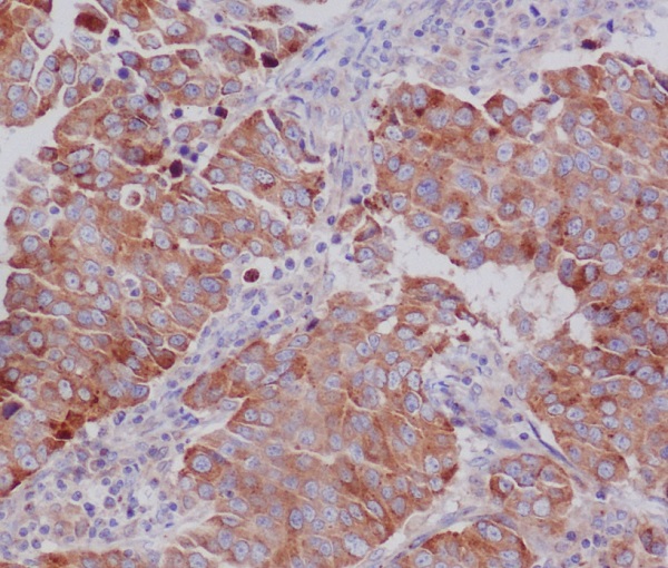 2 - Anti-PUMA BBC3 Rabbit Monoclonal Antibody ABO13376