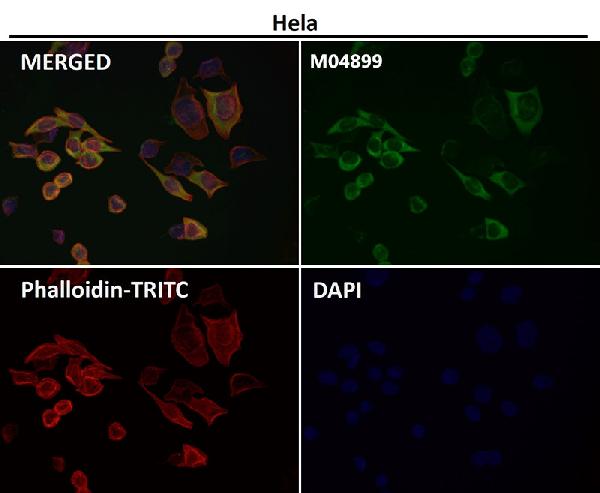 1 - Anti-PUMA BBC3 Rabbit Monoclonal Antibody ABO13376