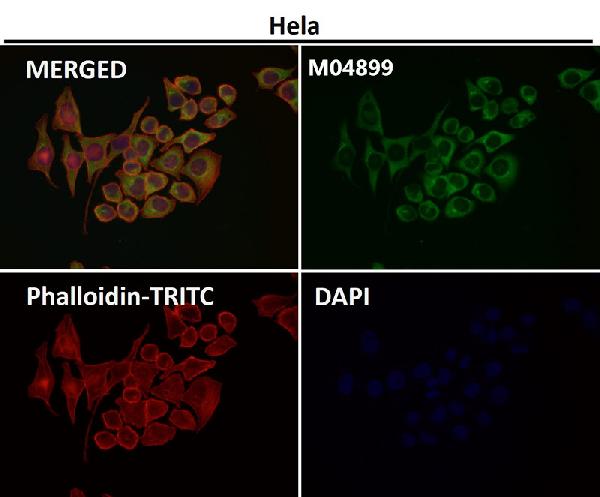 1 - Anti-PUMA BBC3 Rabbit Monoclonal Antibody ABO13376