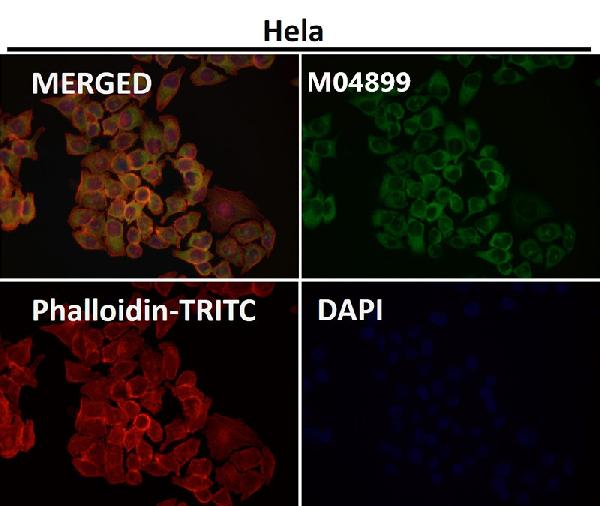1 - Anti-PUMA BBC3 Rabbit Monoclonal Antibody ABO13376