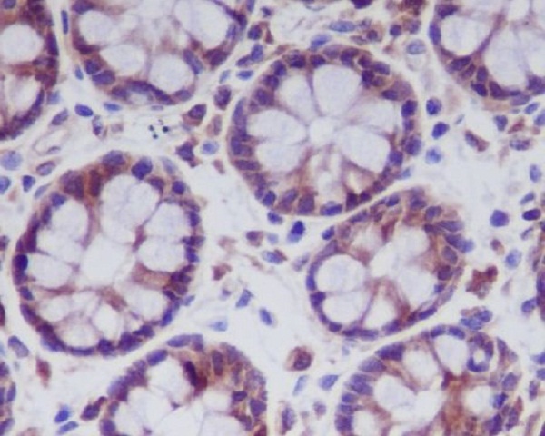 2 - Anti-MLKL Rabbit Monoclonal Antibody ABO13377