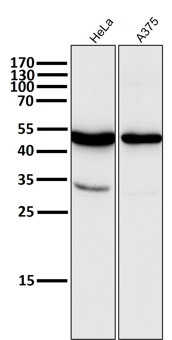 1 - Anti-MLKL Rabbit Monoclonal Antibody ABO13377