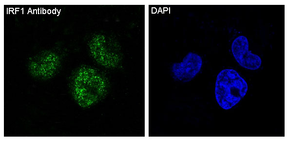 3 - Anti-IRF1 Rabbit Monoclonal Antibody ABO13378