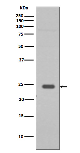 1 - Anti-Rab9 RAB9A Rabbit Monoclonal Antibody ABO13379