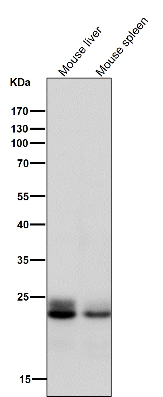 1 - Anti-Rab9 RAB9A Rabbit Monoclonal Antibody ABO13379