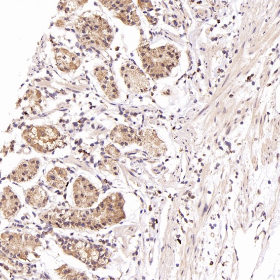 2 - Anti-NeuN RBFOX3 Rabbit Monoclonal Antibody ABO13380