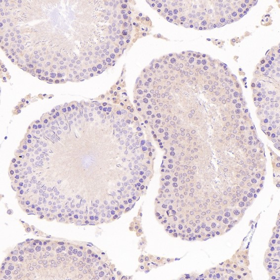 2 - Anti-NeuN RBFOX3 Rabbit Monoclonal Antibody ABO13380