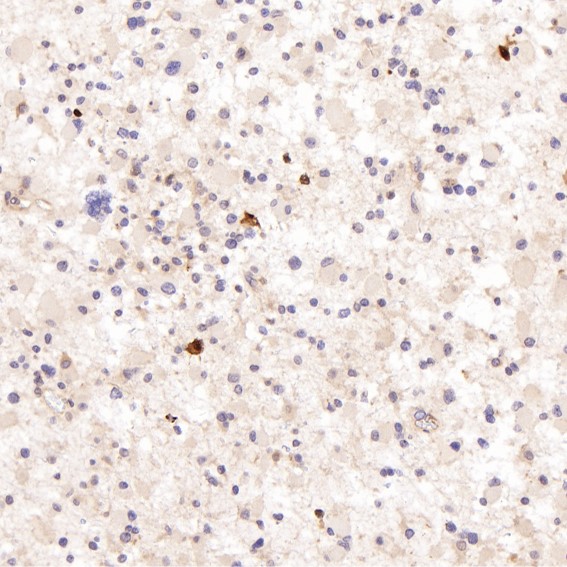 2 - Anti-NeuN RBFOX3 Rabbit Monoclonal Antibody ABO13380