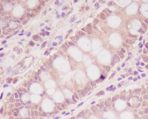 2 - Anti-M6PR IGF2R Rabbit Monoclonal Antibody ABO13381