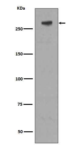1 - Anti-M6PR IGF2R Rabbit Monoclonal Antibody ABO13381