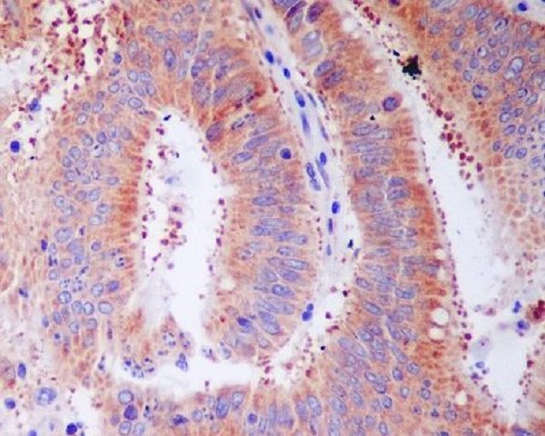 2 - Anti-RPS3/Ribosomal Protein S3 Rabbit Monoclonal Antibody ABO13382
