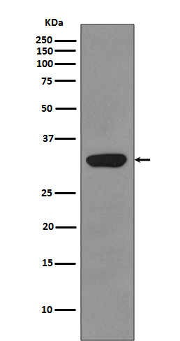 1 - Anti-RPS3/Ribosomal Protein S3 Rabbit Monoclonal Antibody ABO13382