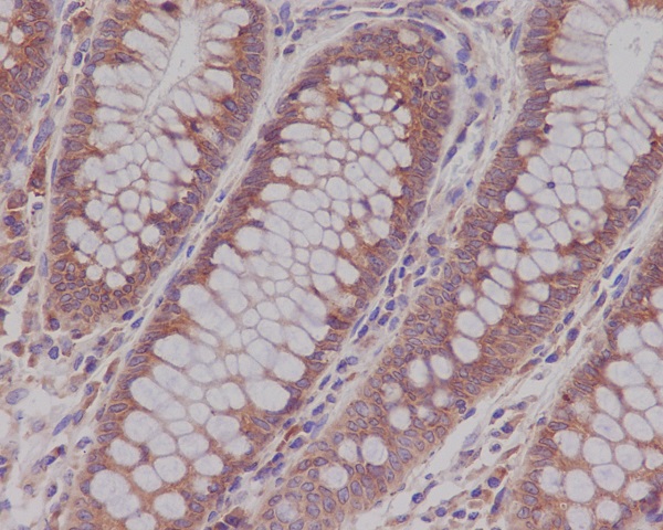 2 - Anti-Rab5 RAB5A Rabbit Monoclonal Antibody ABO13383