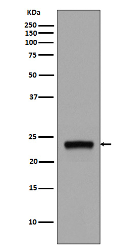 1 - Anti-Rab5 RAB5A Rabbit Monoclonal Antibody ABO13383