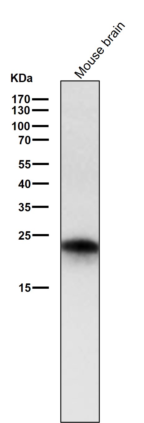 1 - Anti-Rab5 RAB5A Rabbit Monoclonal Antibody ABO13383