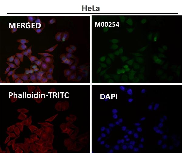 1 - Anti-Ki67 MKI67 Rabbit Monoclonal Antibody ABO13385