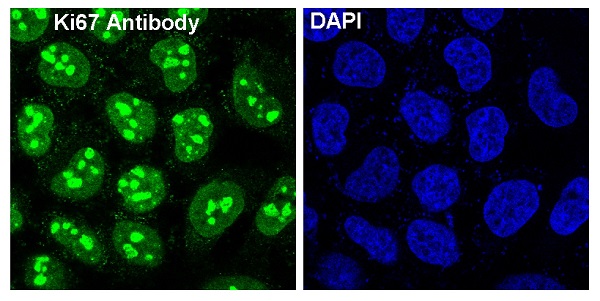 3 - Anti-Ki67 MKI67 Rabbit Monoclonal Antibody ABO13385