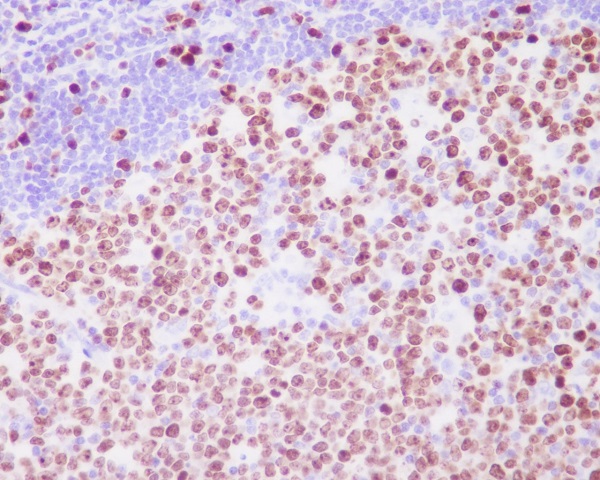 2 - Anti-Ki67 MKI67 Rabbit Monoclonal Antibody ABO13385