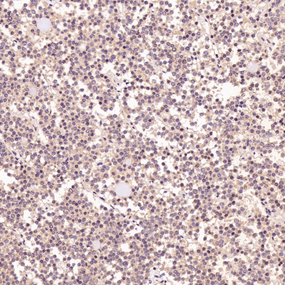 2 - Anti-Ki67 MKI67 Rabbit Monoclonal Antibody ABO13385