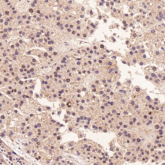 2 - Anti-Ki67 MKI67 Rabbit Monoclonal Antibody ABO13385
