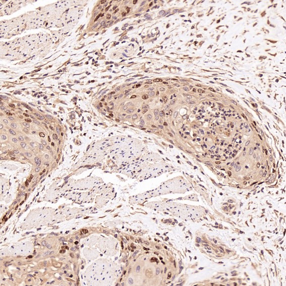 2 - Anti-Ki67 MKI67 Rabbit Monoclonal Antibody ABO13385