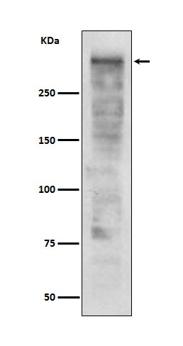 1 - Anti-Ki67 MKI67 Rabbit Monoclonal Antibody ABO13385
