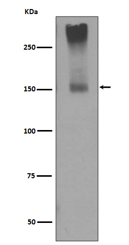 1 - Anti-GRM5/Mglur5 Rabbit Monoclonal Antibody ABO13386