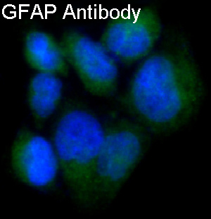 3 - Anti-GFAP Rabbit Monoclonal Antibody ABO13387