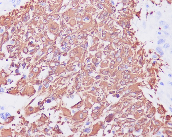 2 - Anti-GFAP Rabbit Monoclonal Antibody ABO13387