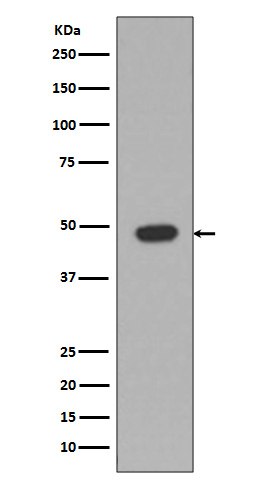 1 - Anti-GFAP Rabbit Monoclonal Antibody ABO13387