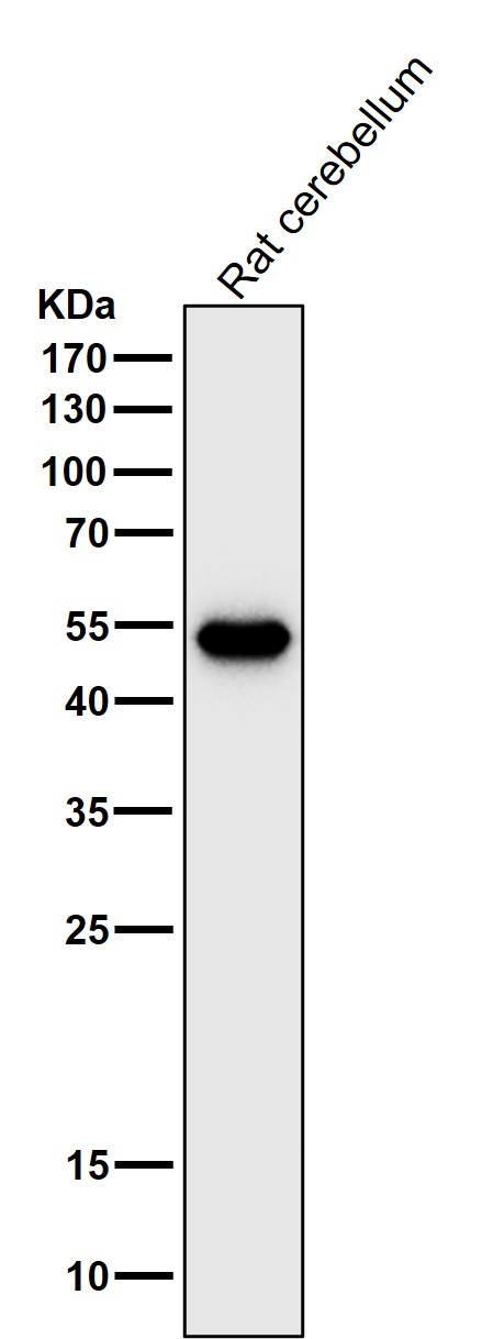 1 - Anti-GFAP Rabbit Monoclonal Antibody ABO13387