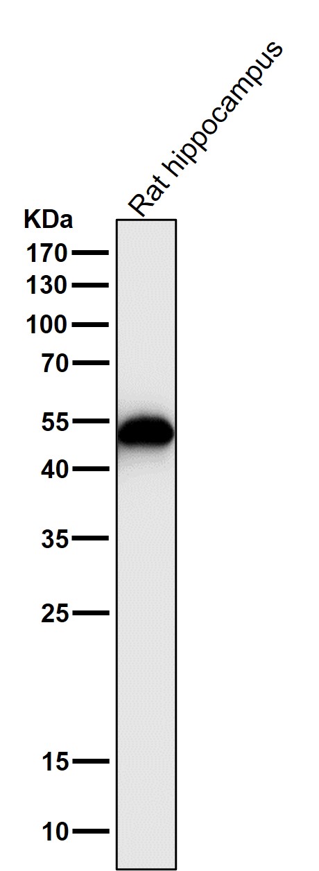 1 - Anti-GFAP Rabbit Monoclonal Antibody ABO13387