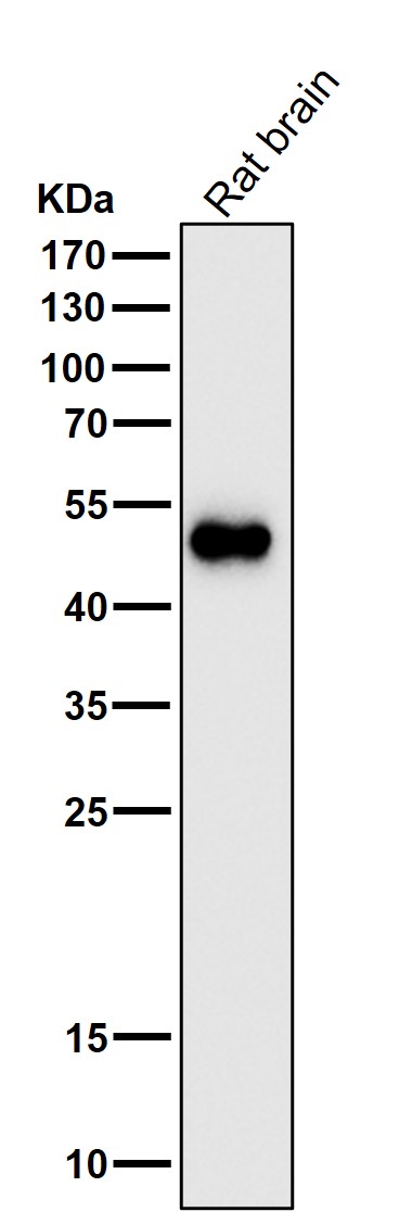 1 - Anti-GFAP Rabbit Monoclonal Antibody ABO13387