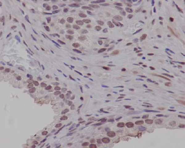 2 - Anti-PIM1 Rabbit Monoclonal Antibody ABO13388