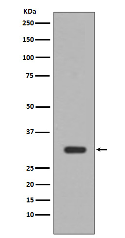 1 - Anti-PIM1 Rabbit Monoclonal Antibody ABO13388