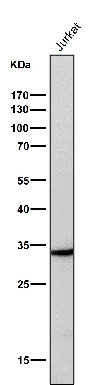1 - Anti-PIM1 Rabbit Monoclonal Antibody ABO13388
