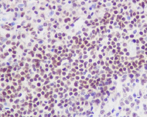 2 - Anti-FLI1 Rabbit Monoclonal Antibody ABO13389