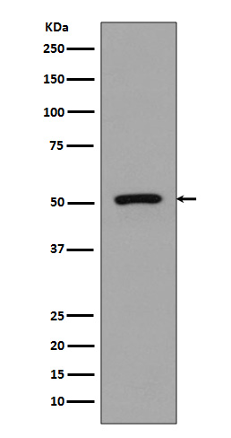 1 - Anti-FLI1 Rabbit Monoclonal Antibody ABO13389