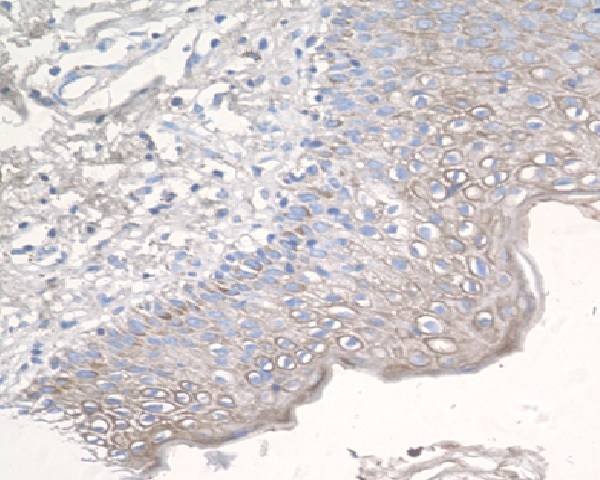 2 - Anti-CCR3 Rabbit Monoclonal Antibody ABO13390
