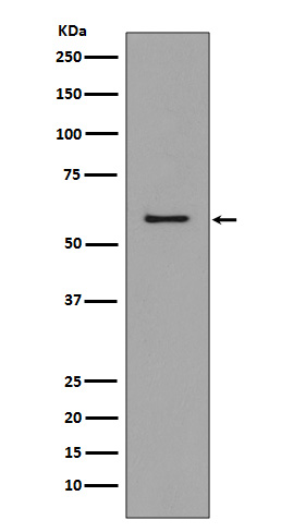 1 - Anti-CCR3 Rabbit Monoclonal Antibody ABO13390