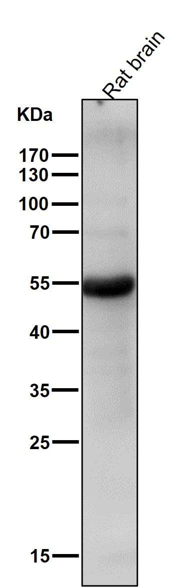 1 - Anti-CCR3 Rabbit Monoclonal Antibody ABO13390