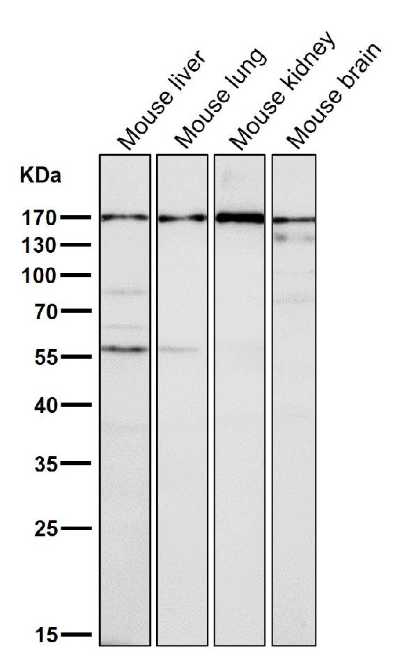1 - Anti-EEA1 Rabbit Monoclonal Antibody ABO13391
