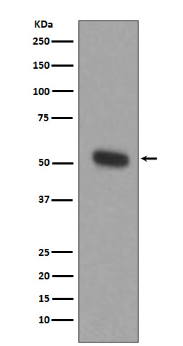 1 - Anti-TPH1/Tph Rabbit Monoclonal Antibody ABO13392