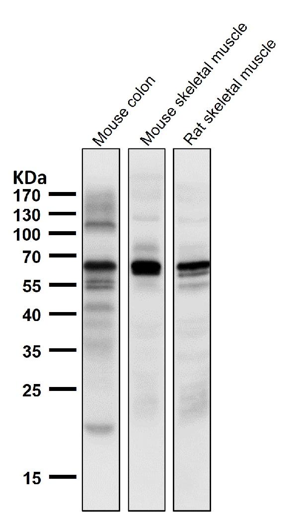 1 - Anti-TPH1/Tph Rabbit Monoclonal Antibody ABO13392