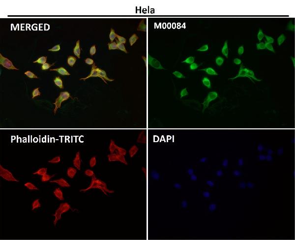 1 - Anti-COX2 PTGS2 Rabbit Monoclonal Antibody ABO13393